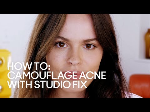  HOW TO: Camouflage Acne with Studio Fix
