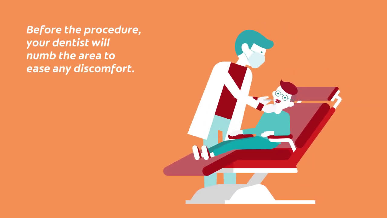  What is a Filling & When do you need One?