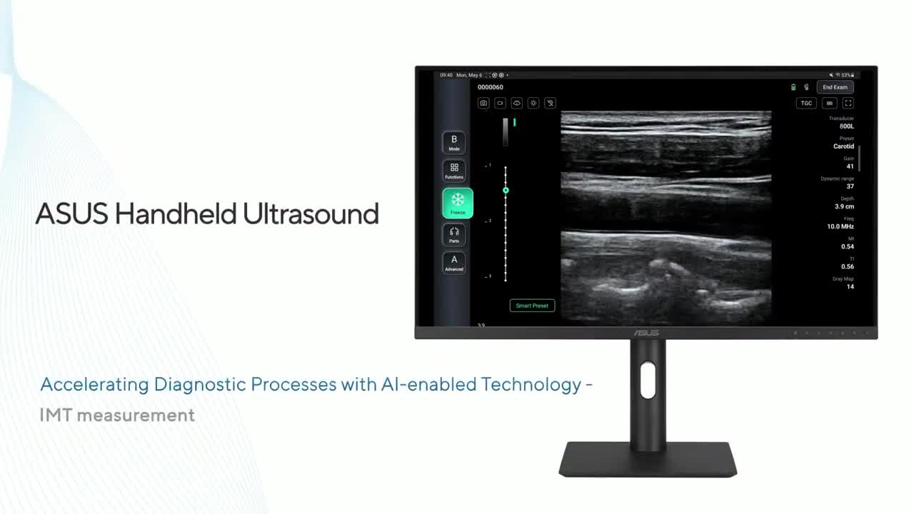 Asus Handheld Ultrasound LU800 | Introduction to IMT 
