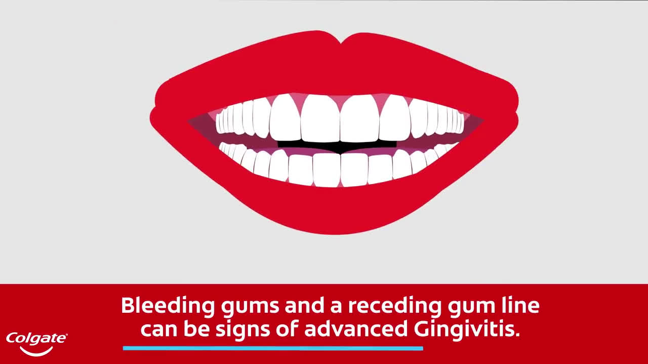  Bleeding Gums and the Signs of Gingivitis
