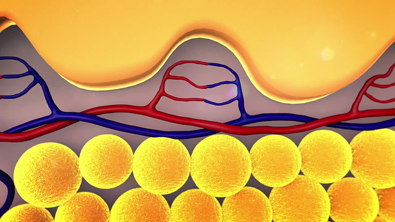 Groupon Laser Lipo What To Expect Ad Commercial on TV